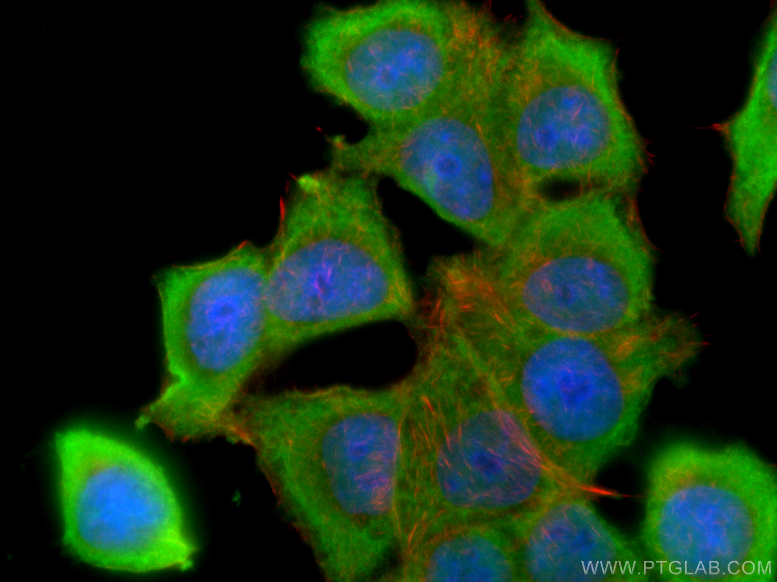 IF Staining of MCF-7 using 60178-1-Ig