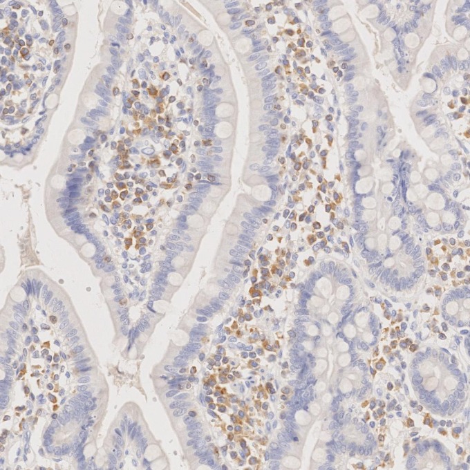 IHC staining of human small intestine using 60178-1-Ig IHC staining of human small intestine using 60178-1-Ig
