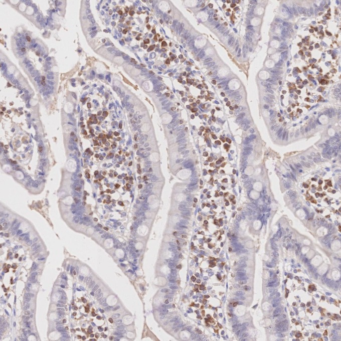 IHC staining of human small intestine using 60178-1-Ig IHC staining of human small intestine using 60178-1-Ig