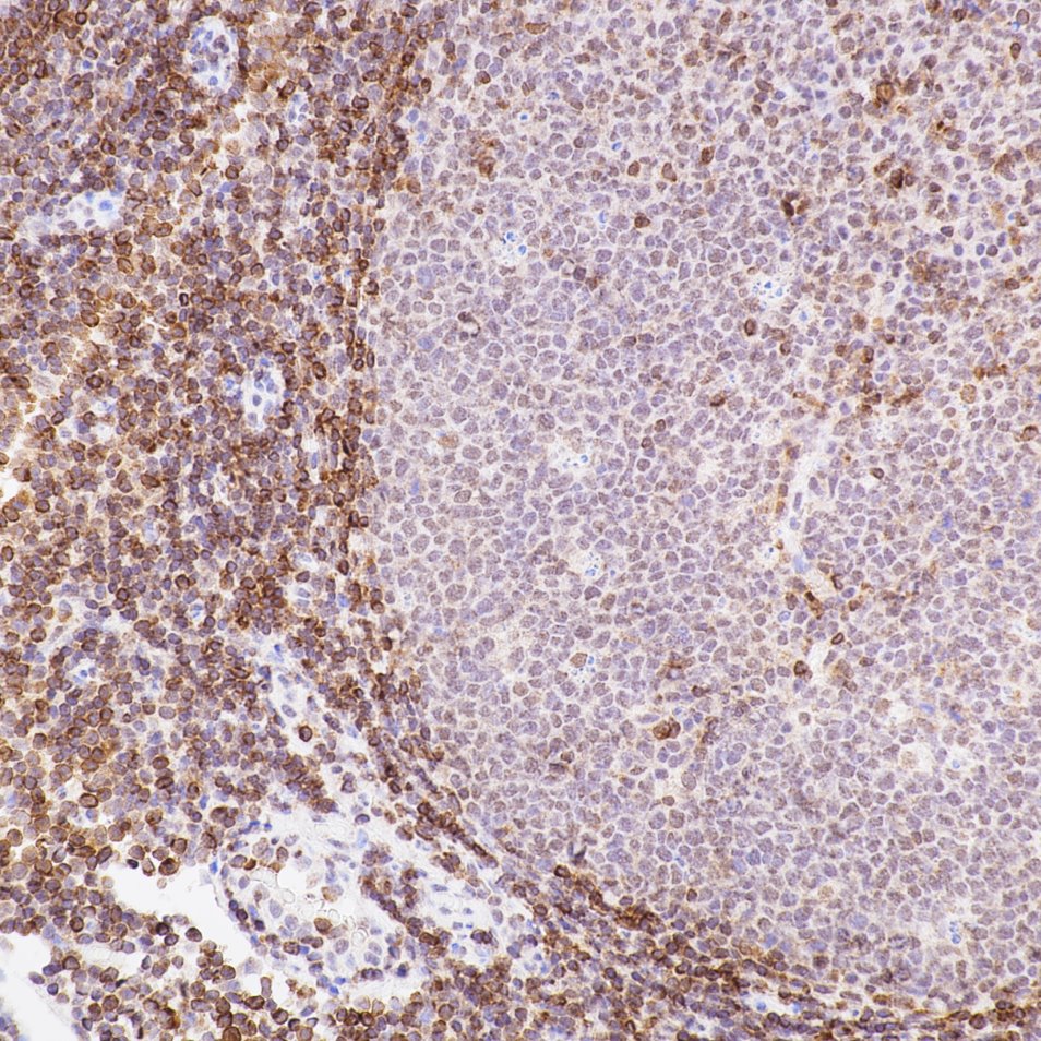 IHC staining of Human Tonsil​ using 80313-1-RR (same clone as 80313-1-PBS)