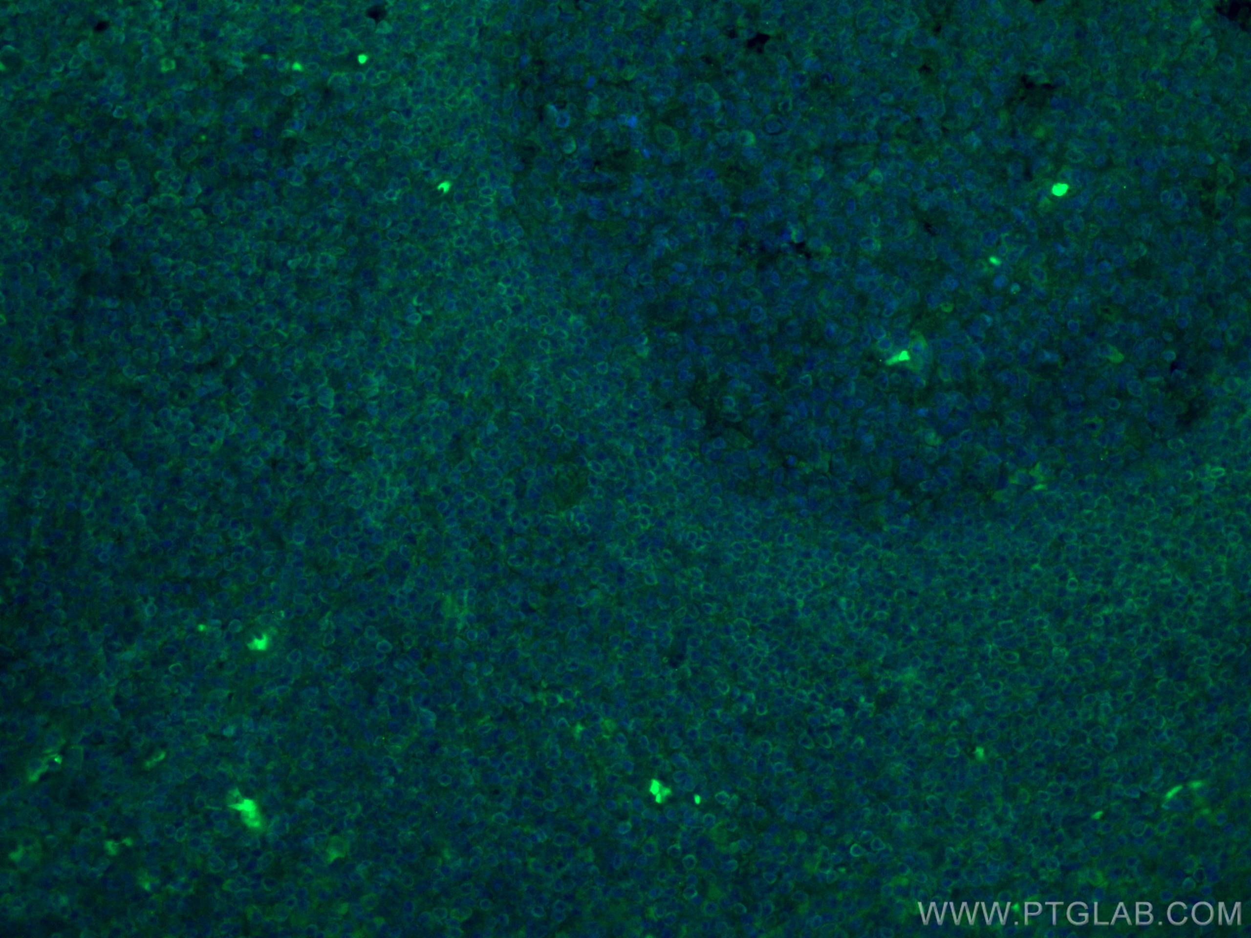 IF Staining of human tonsillitis using CL488-60178