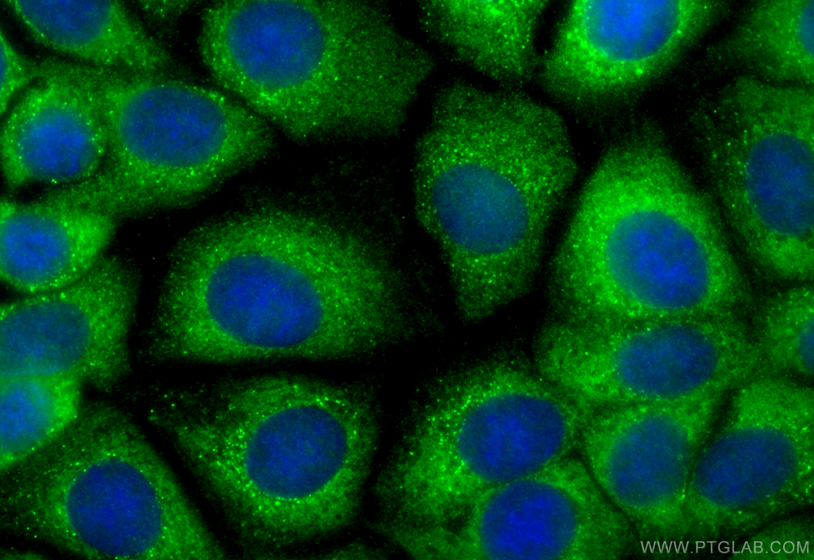 IF Staining of MCF-7 using CL488-80313