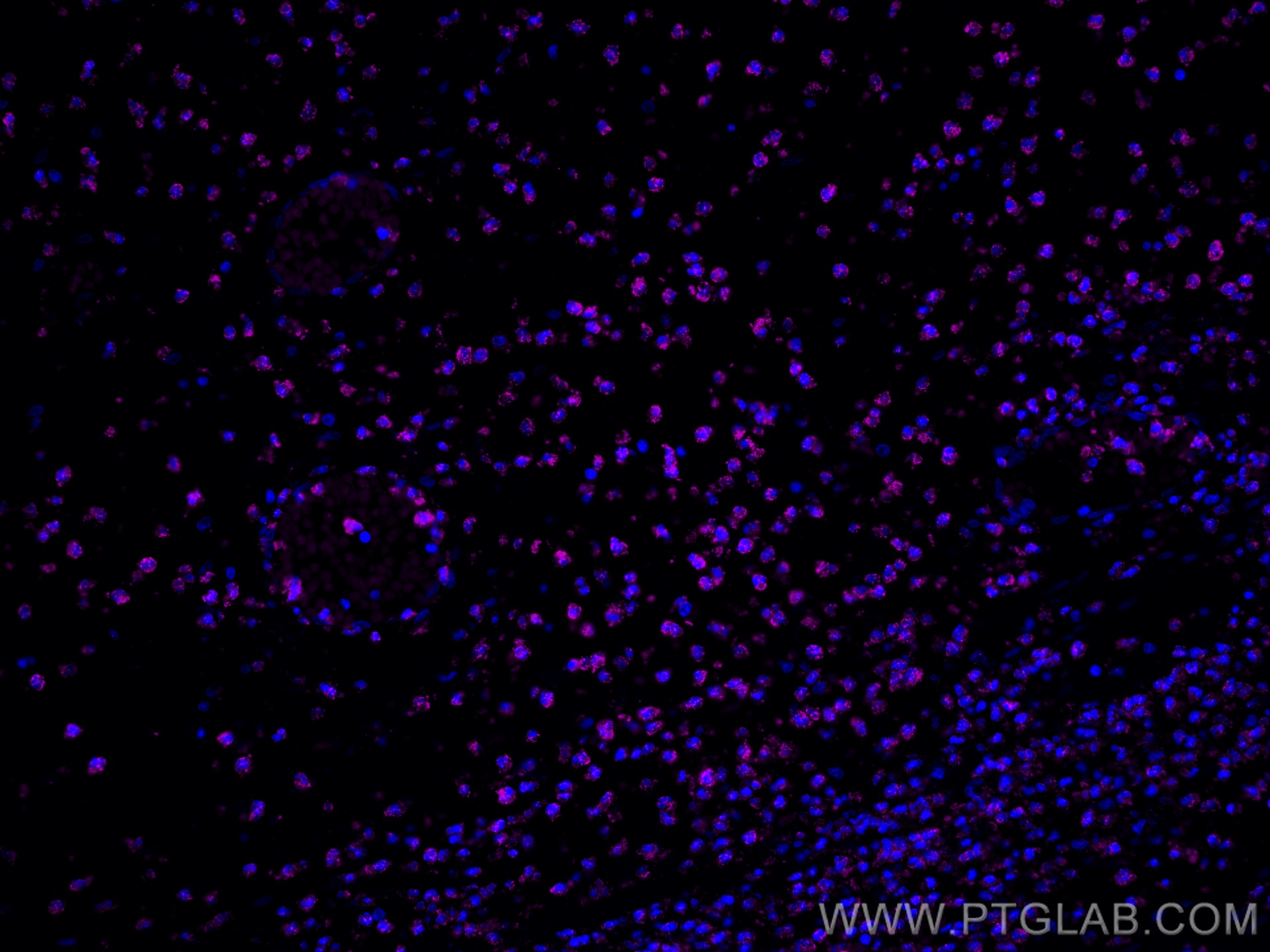 IF Staining of human appendicitis using CL647-80313