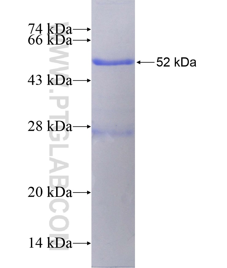 BCL2 fusion protein Ag3508 SDS-PAGE