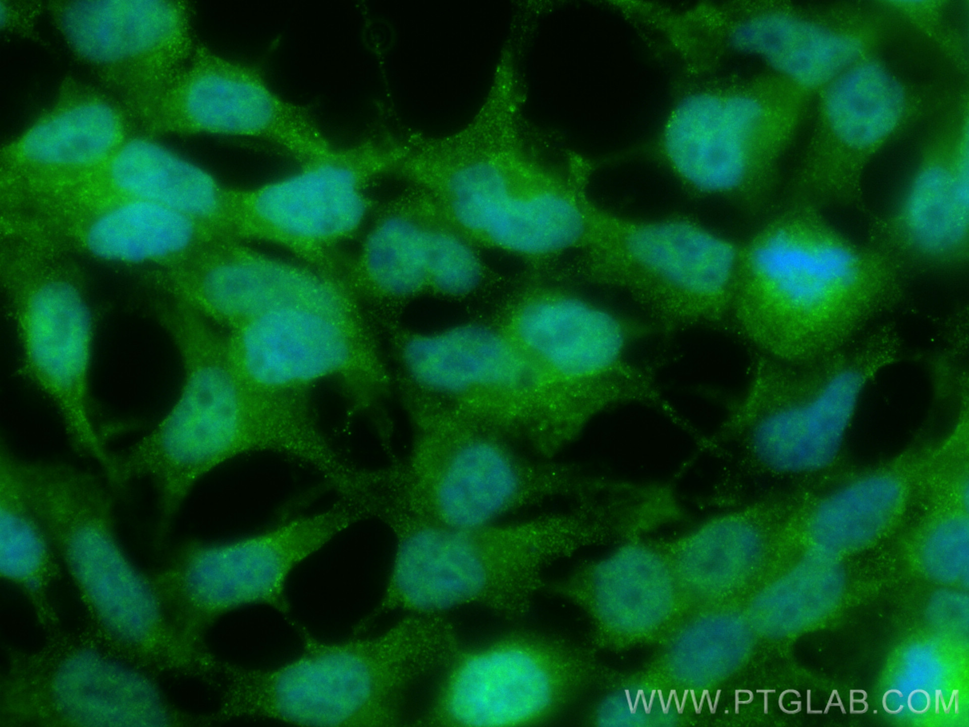 IF Staining of HEK-293 using 23975-1-AP