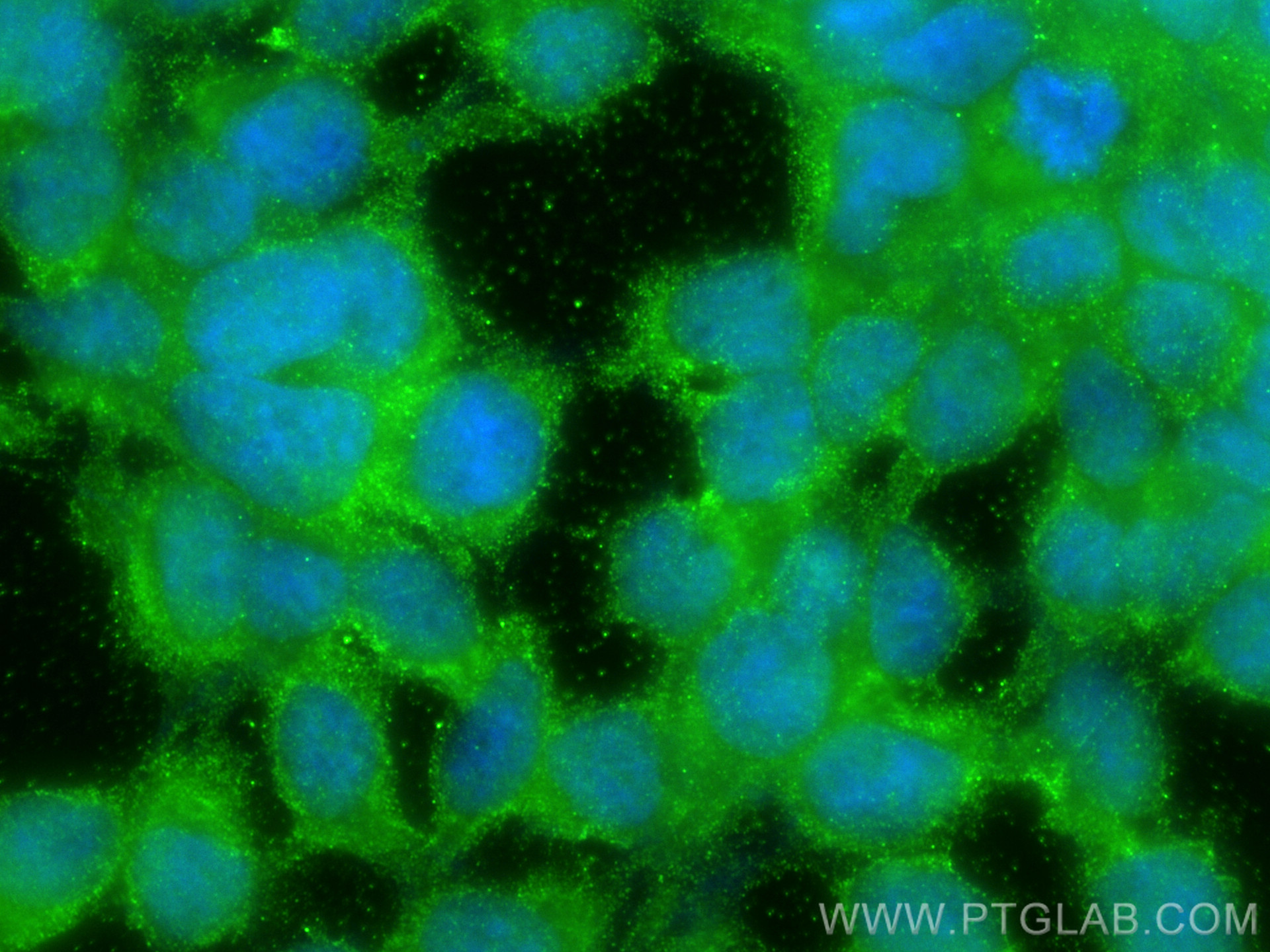 IF Staining of HEK-293 using 23975-1-AP