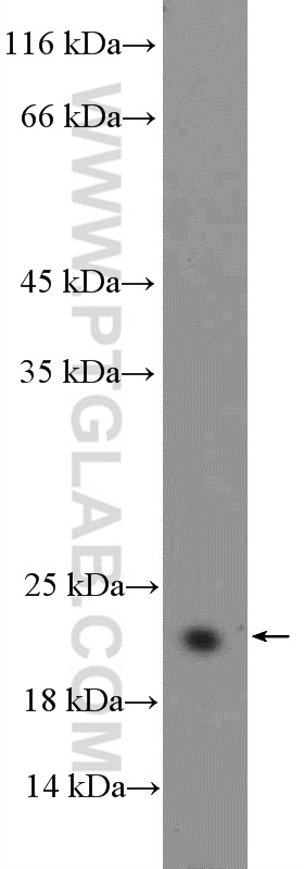 WB analysis of HL-60 using 16026-1-AP