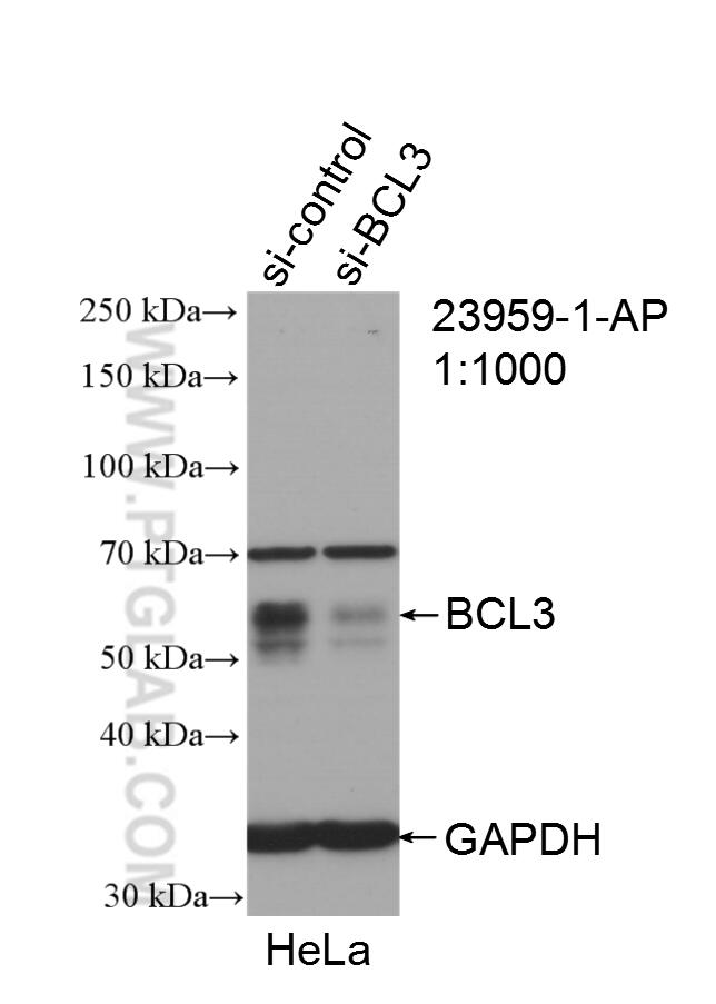 WB analysis of HeLa using 23959-1-AP