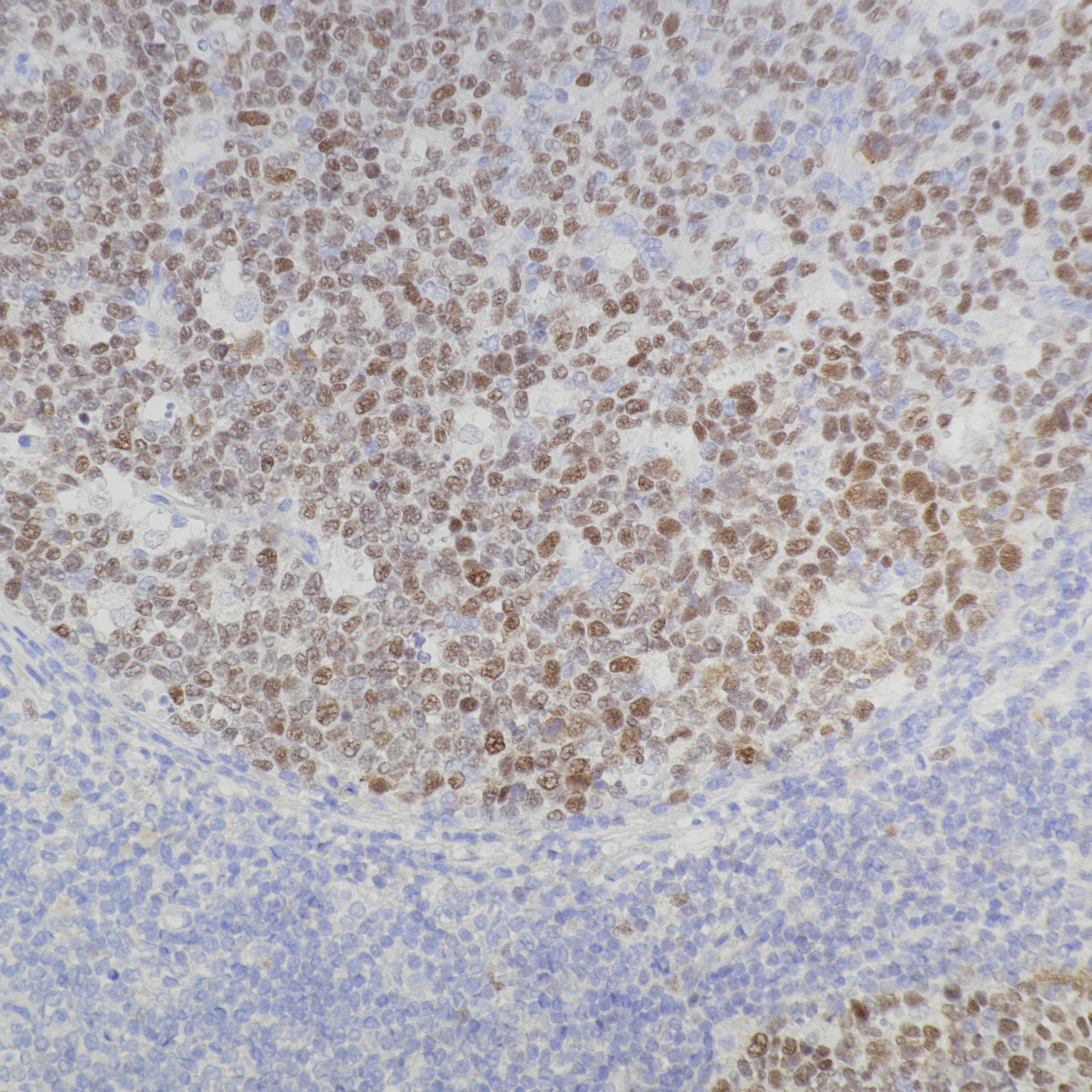 IHC staining of human tonsil using 81754-1-RR