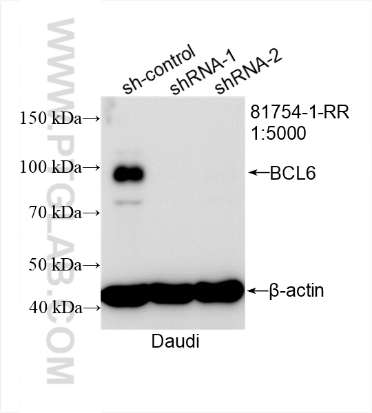 WB analysis of Daudi using 81754-1-RR