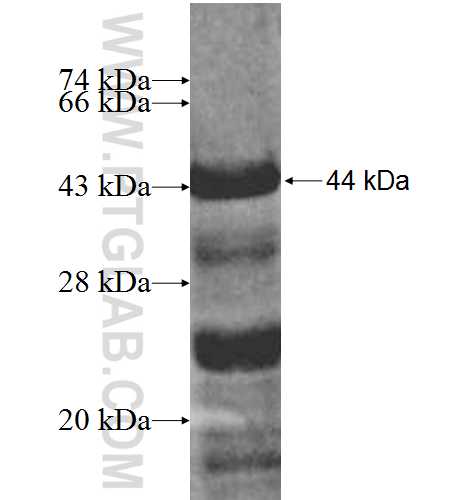 BCL6B fusion protein Ag5408 SDS-PAGE BCL6B fusion protein Ag5408 SDS-PAGE