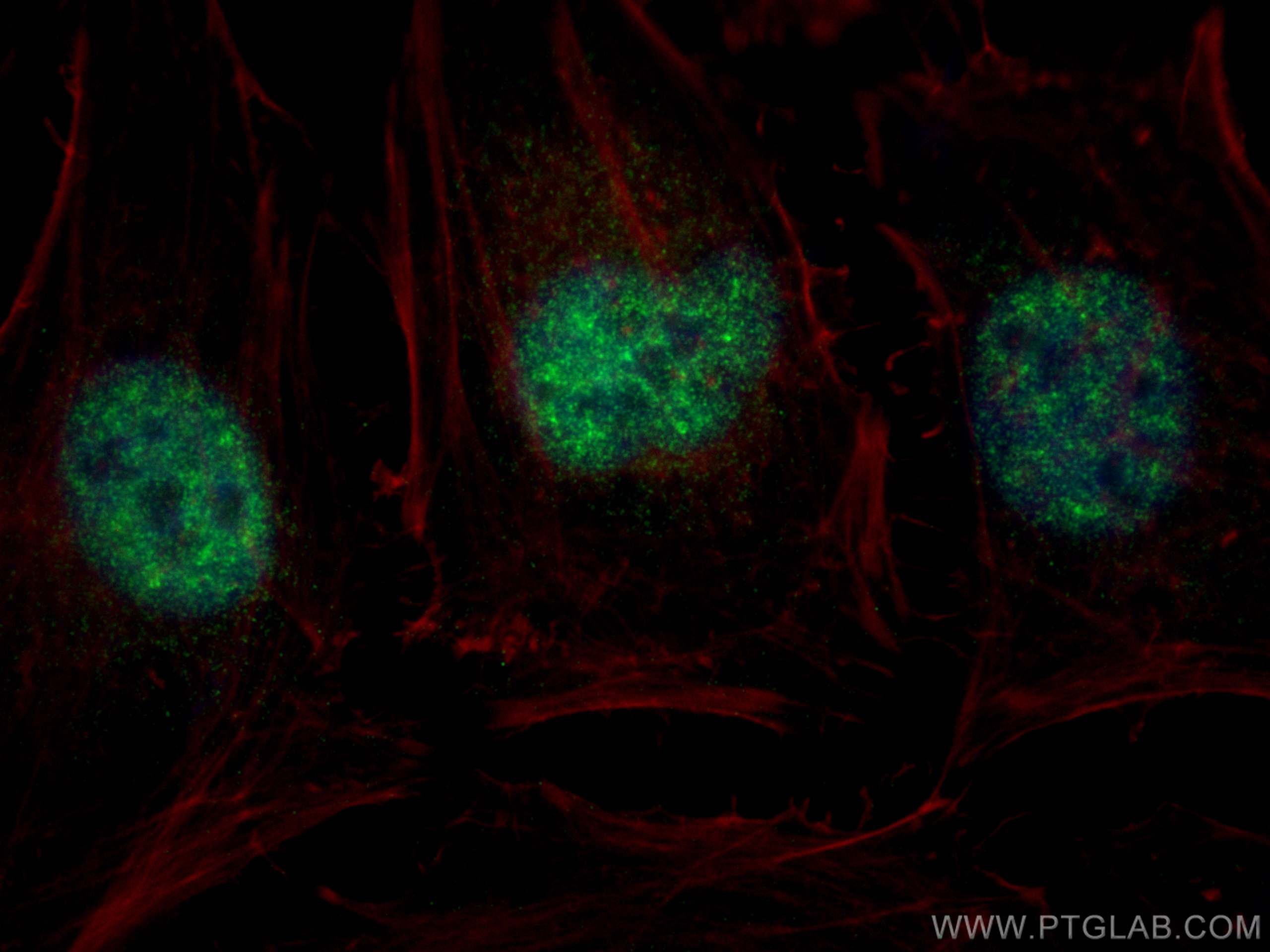 IF Staining of HeLa using 22947-1-AP