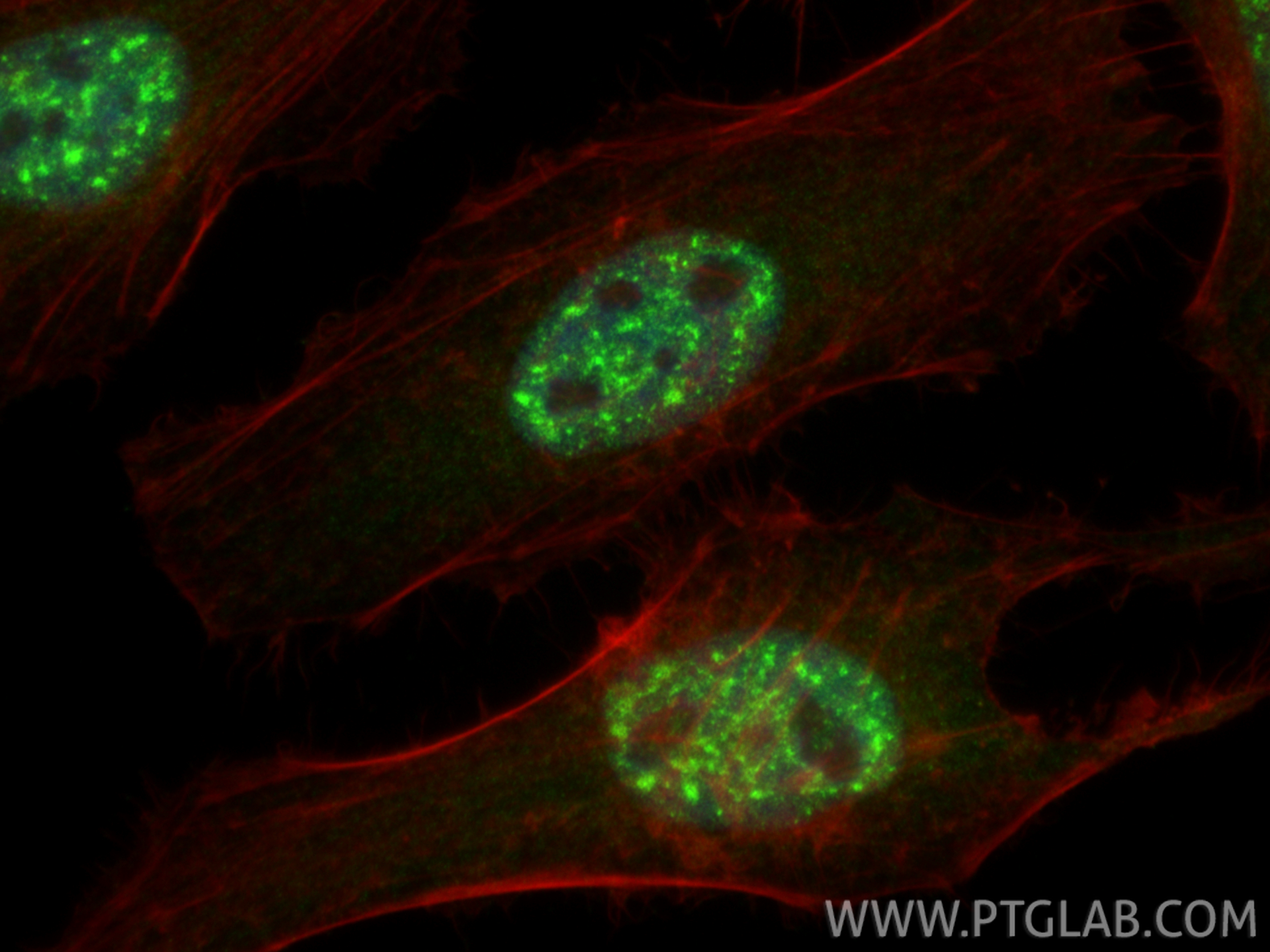 IF Staining of HeLa using 22947-1-AP IF Staining of HeLa using 22947-1-AP
