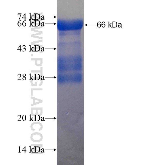BCL9 fusion protein Ag19158 SDS-PAGE