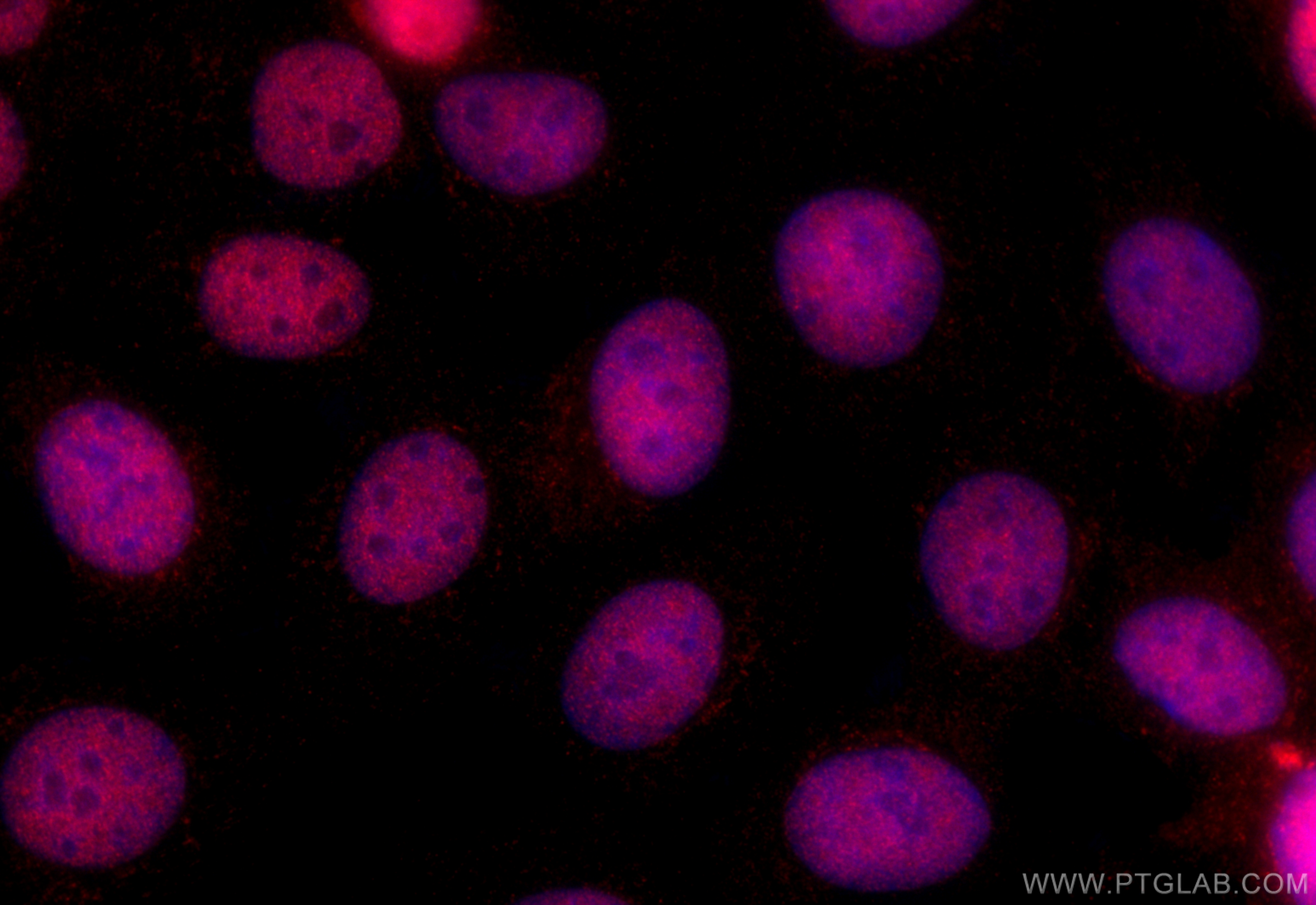 IF Staining of MCF-7 using 32103-1-AP