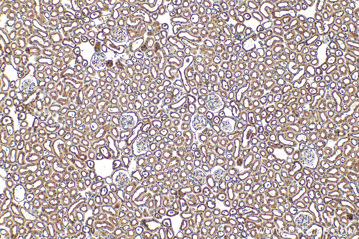 Immunohistochemical analysis of paraffin-embedded mouse kidney tissue slide using 26809-1-AP (BCLAF1 antibody) at dilution of 1:200 (under 10x lens). Heat mediated antigen retrieval with Tris-EDTA buffer (pH 9.0). IHC staining of mouse kidney using 26809-1-AP