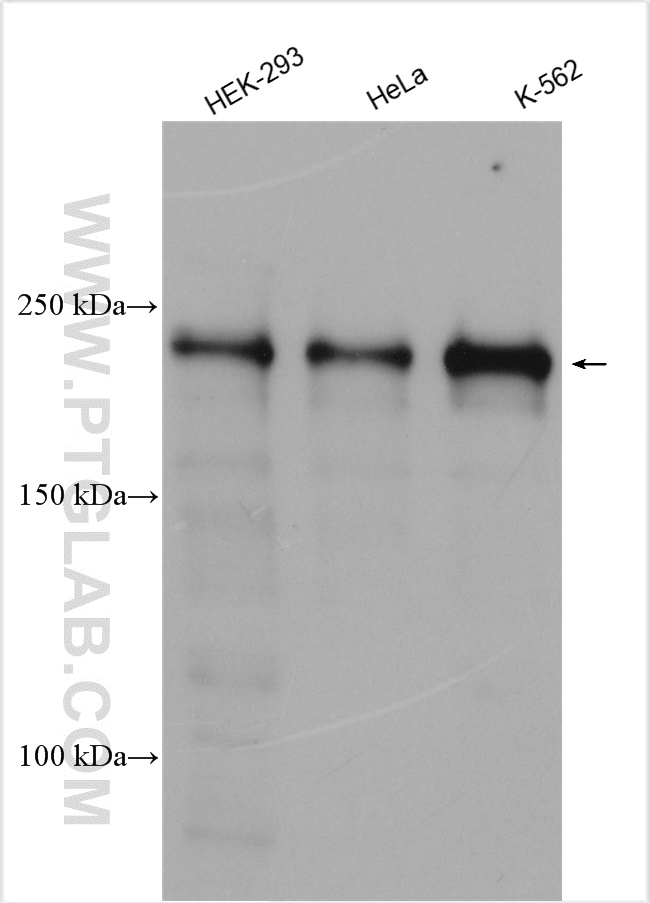 WB analysis using 12107-1-AP