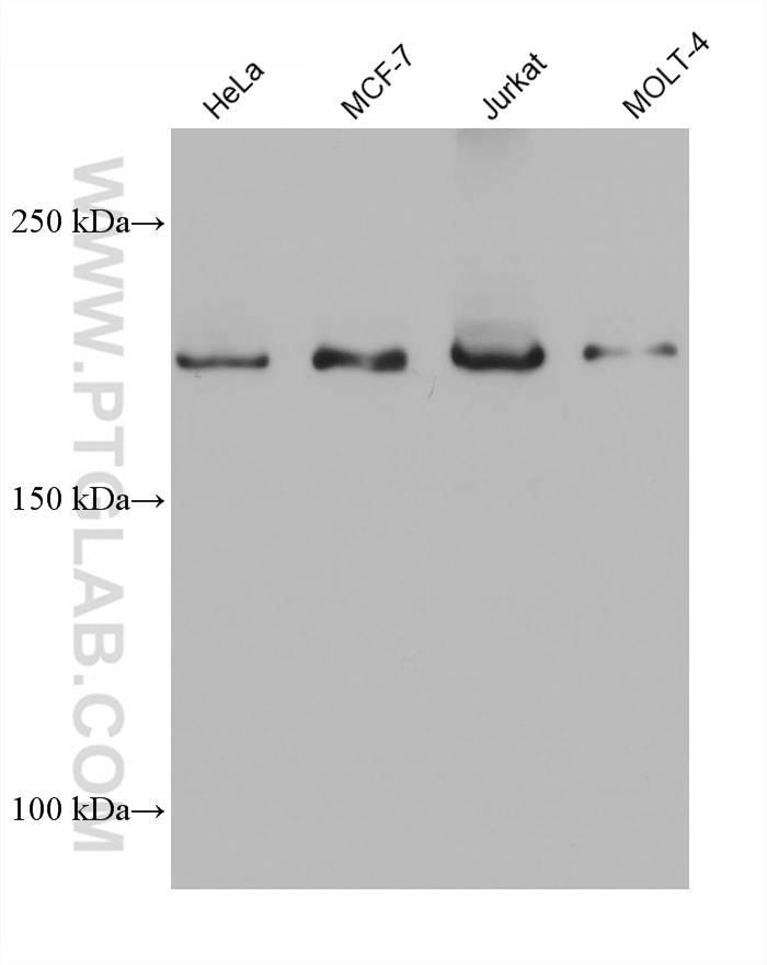 WB analysis using 68611-1-Ig