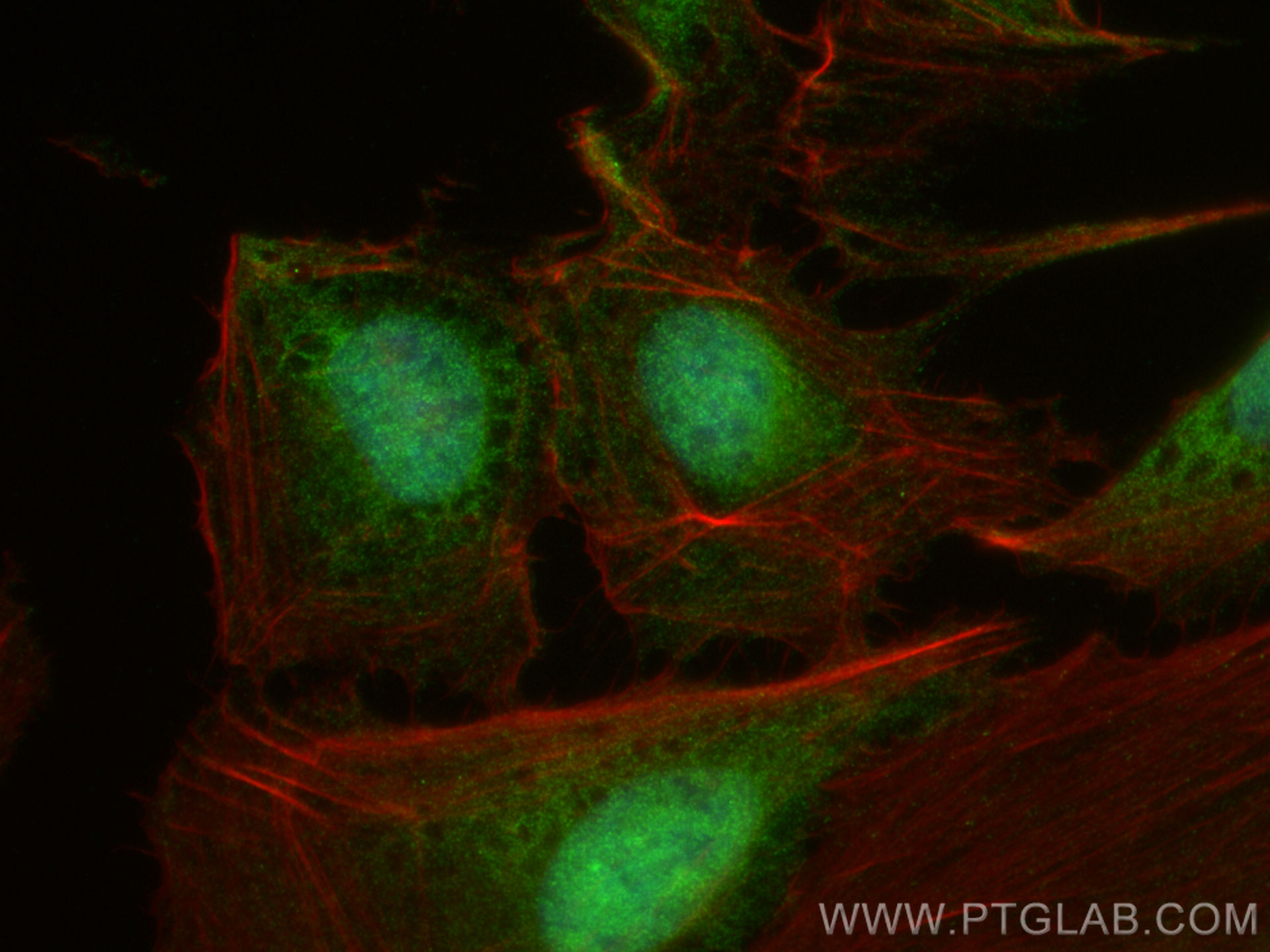 IF Staining of U2OS using 24315-1-AP (same clone as 24315-1-PBS) IF Staining of U2OS using 24315-1-AP (same clone as 24315-1-PBS)
