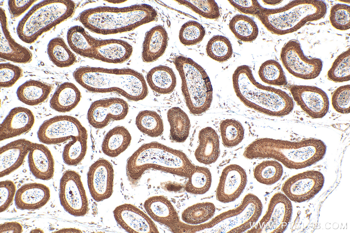 IHC staining of mouse testis using 24315-1-AP (same clone as 24315-1-PBS) IHC staining of mouse testis using 24315-1-AP (same clone as 24315-1-PBS)