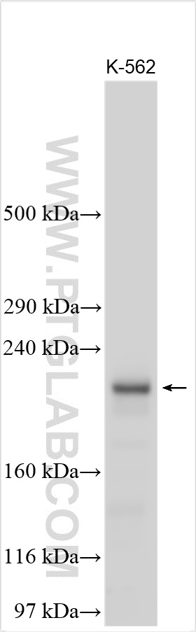WB analysis using 24315-1-AP (same clone as 24315-1-PBS) WB analysis using 24315-1-AP (same clone as 24315-1-PBS)