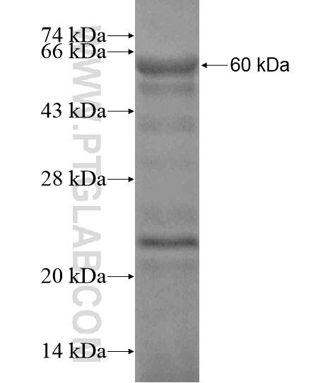 BCORL1 fusion protein Ag19674 SDS-PAGE BCORL1 fusion protein Ag19674 SDS-PAGE
