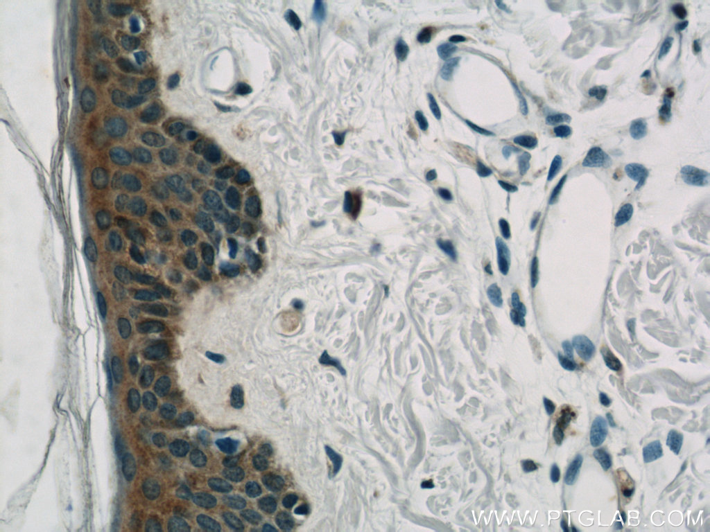 IHC staining of human skin using 22585-1-AP