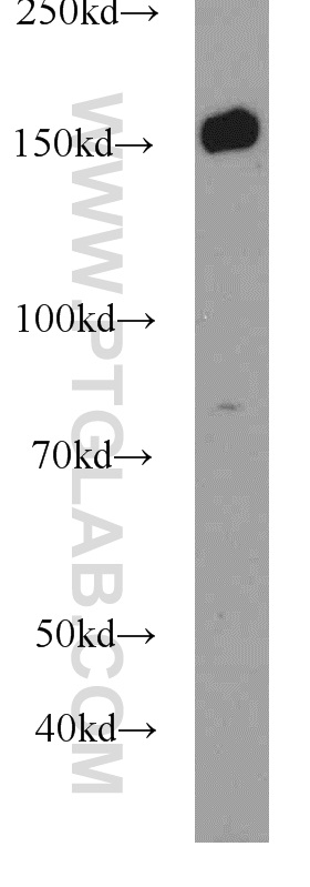 WB analysis of Y79 using 22585-1-AP