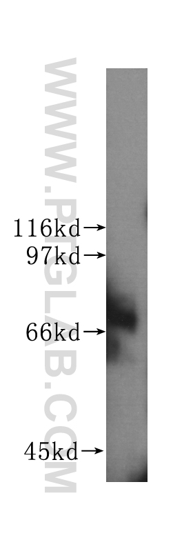 WB analysis of Jurkat using 60080-1-Ig