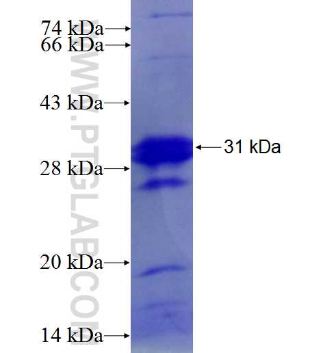 BCRP,ABCG2 fusion protein Ag4869 SDS-PAGE