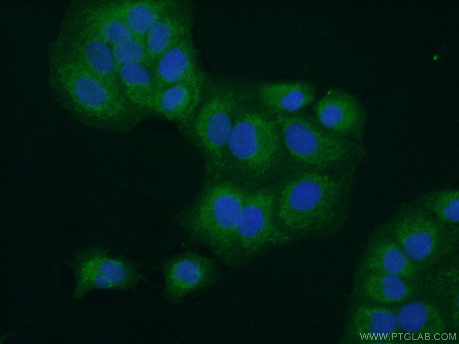 IF Staining of A549 using 10175-2-AP