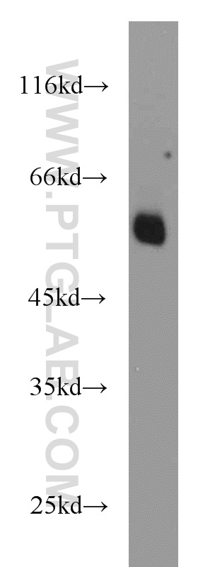 WB analysis of A549 using 10175-2-AP