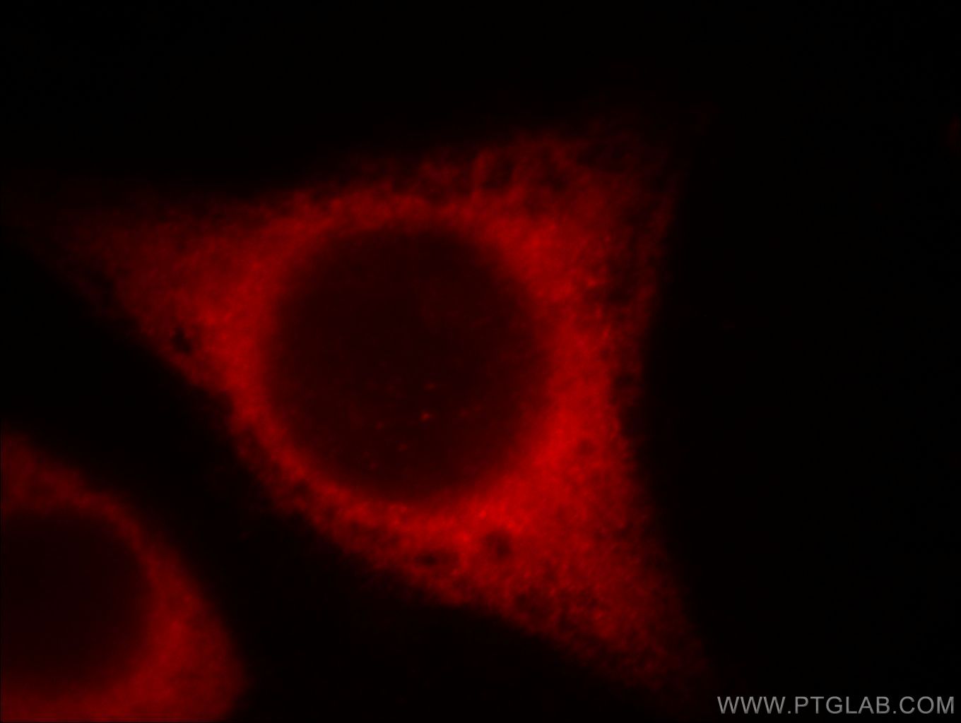 IF Staining of MCF-7 using 60212-1-Ig (same clone as 60212-1-PBS)