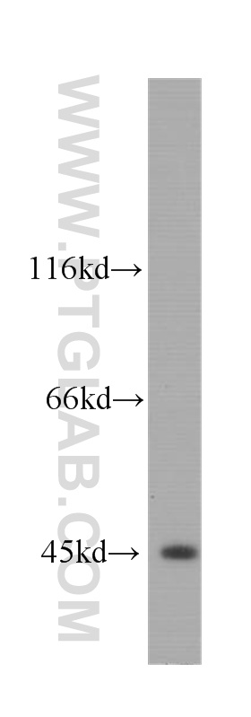 WB analysis of COLO 320 using 60212-1-Ig (same clone as 60212-1-PBS)