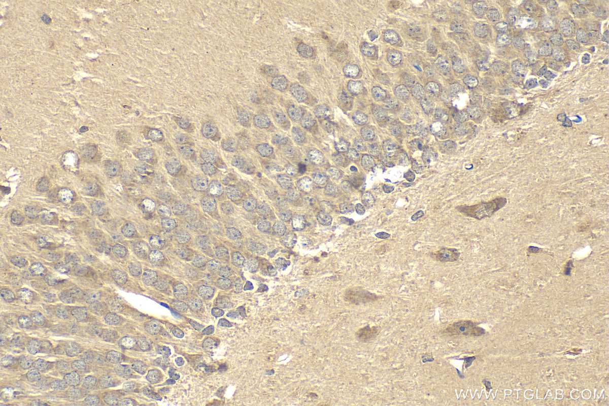 IHC staining of rat brain using 15417-1-AP