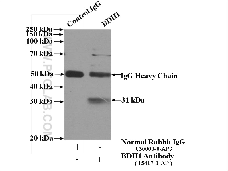 IP experiment of mouse liver using 15417-1-AP