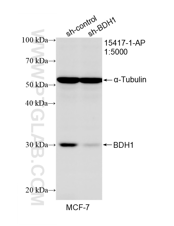 WB result of BDH1 antibody (15417-1-AP; 1:5000; incubated at room temperature for 1.5 hours) with sh-Control and sh-BDH1 transfected MCF-7 cells. WB analysis of MCF-7 using 15417-1-AP