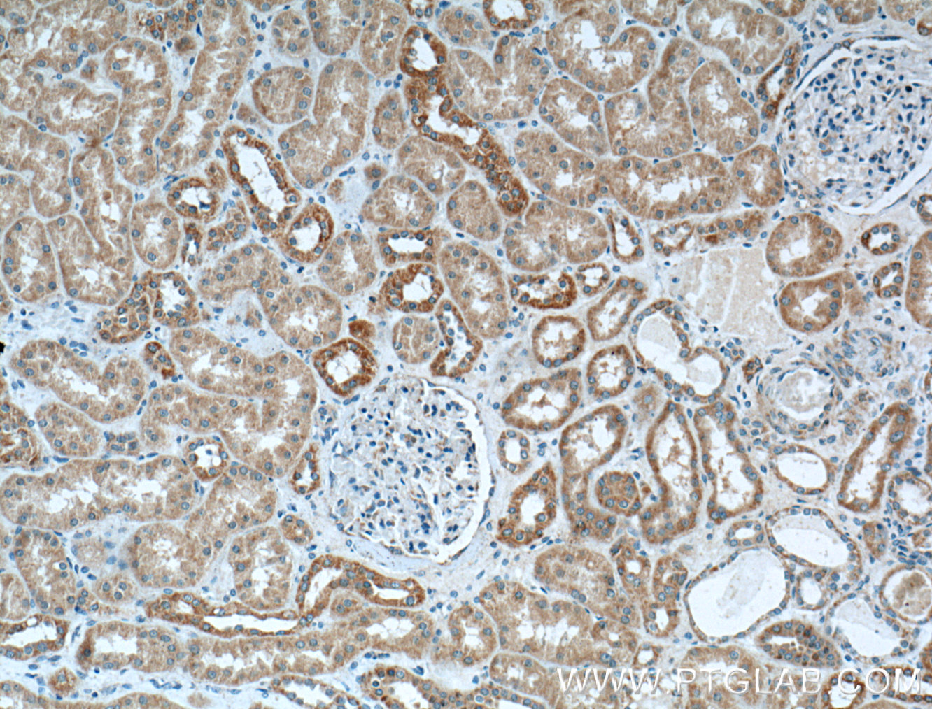 IHC staining of human kidney using 26672-1-AP