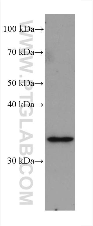 WB analysis of U-251 using 66292-1-Ig