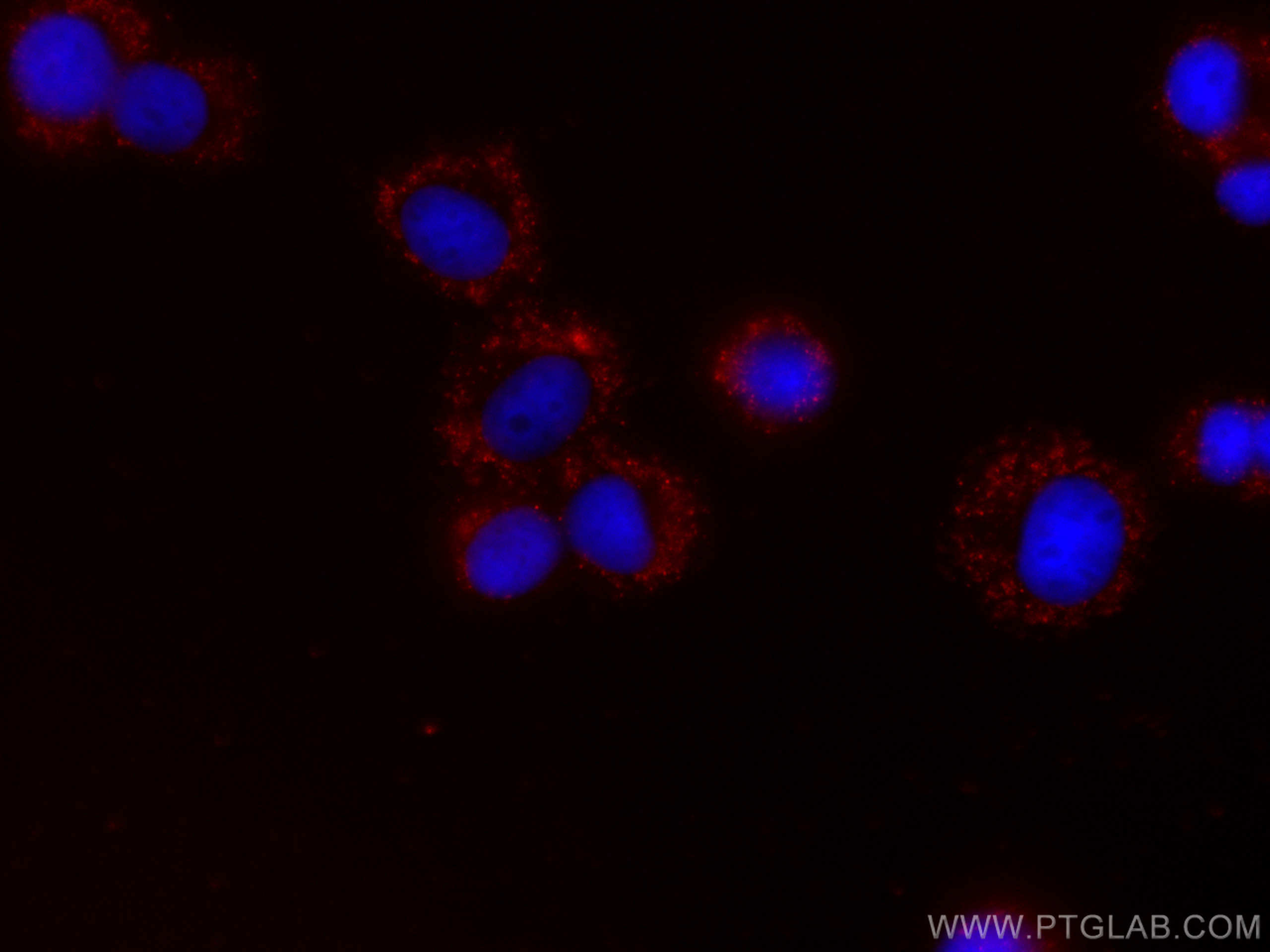 IF Staining of PC-12 using CL594-66292