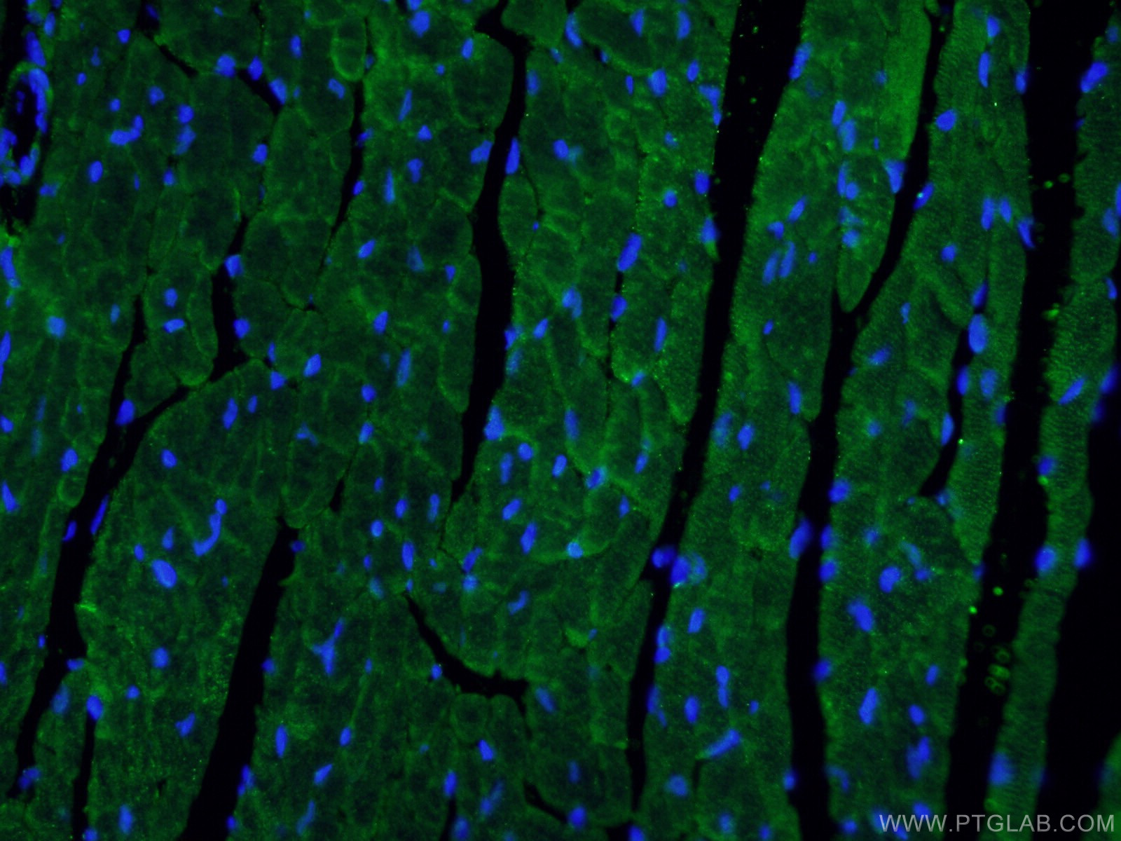 IF Staining of mouse heart using 11306-1-AP