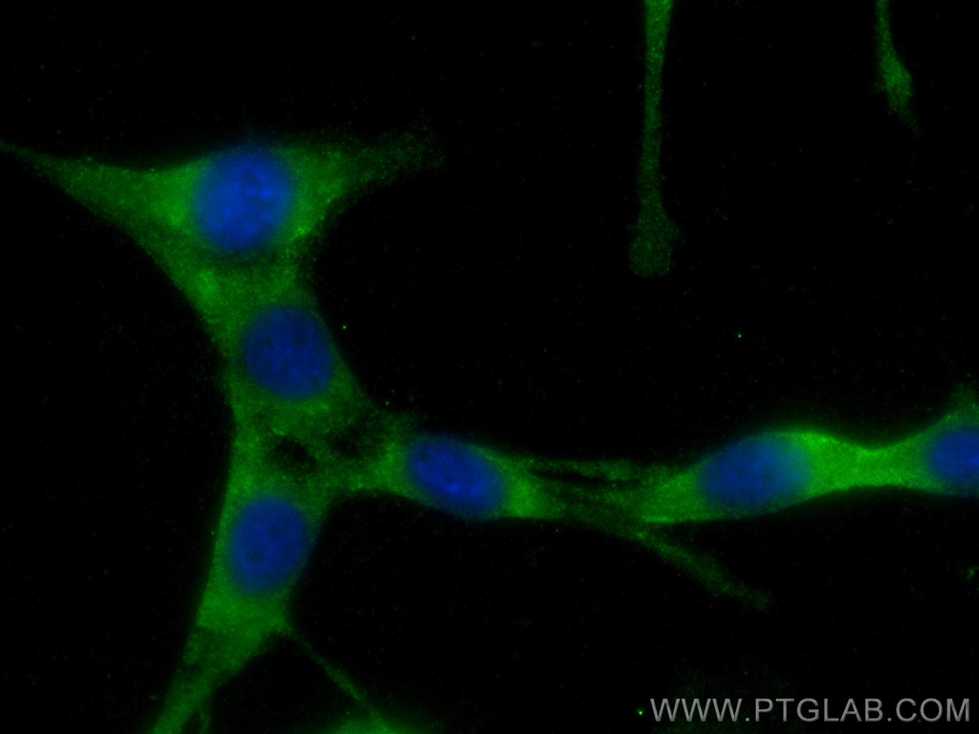 IF Staining of NIH/3T3 using 11306-1-AP