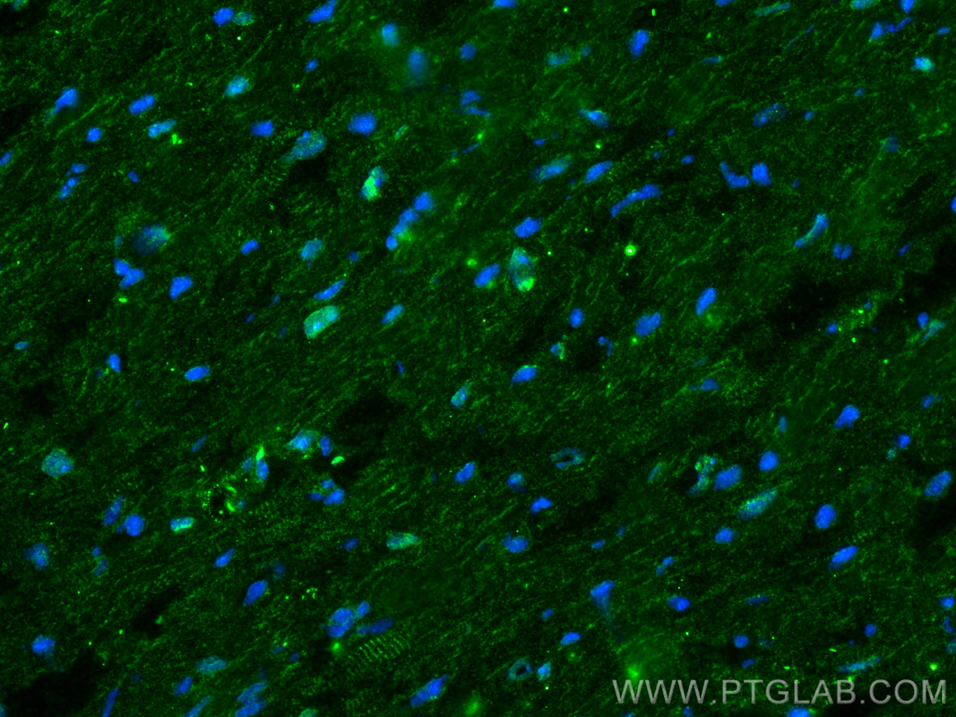 IF Staining of mouse heart using 11306-1-AP