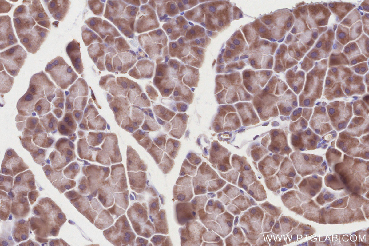 IHC staining of mouse pancreas using 14956-1-AP IHC staining of mouse pancreas using 14956-1-AP