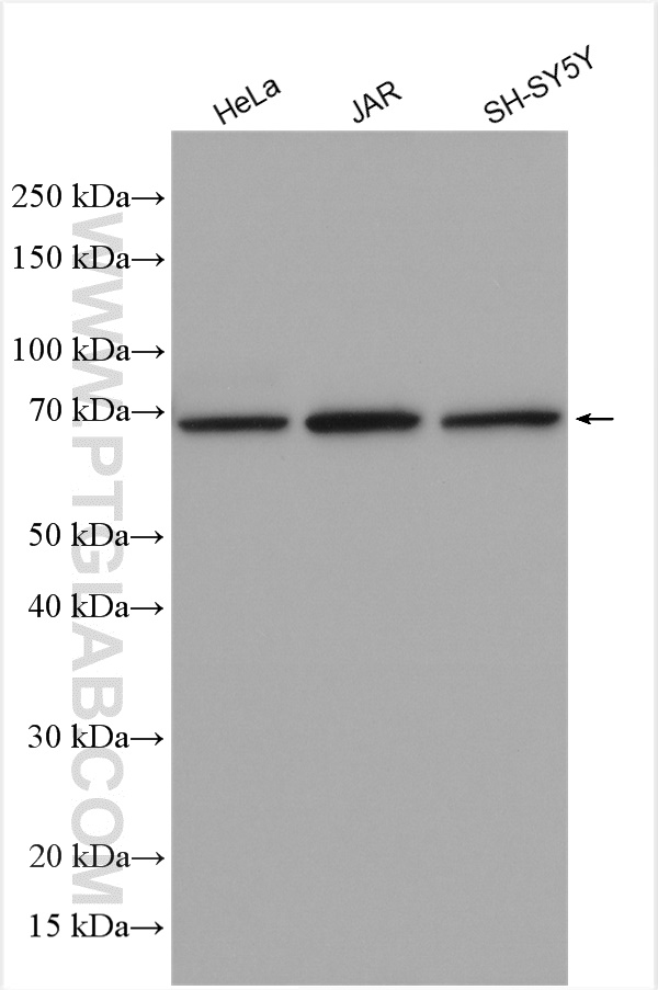 WB analysis using 14956-1-AP