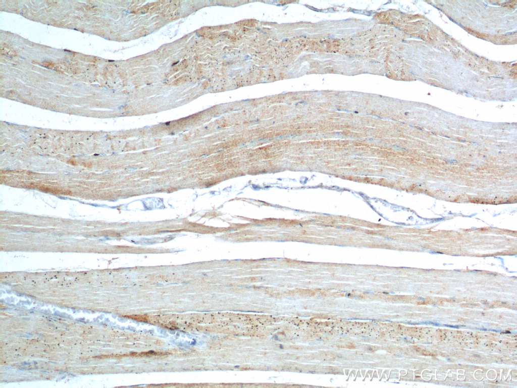 IHC staining of human skeletal muscle using 20443-1-AP