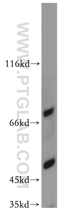 WB analysis of mouse colon using 20443-1-AP