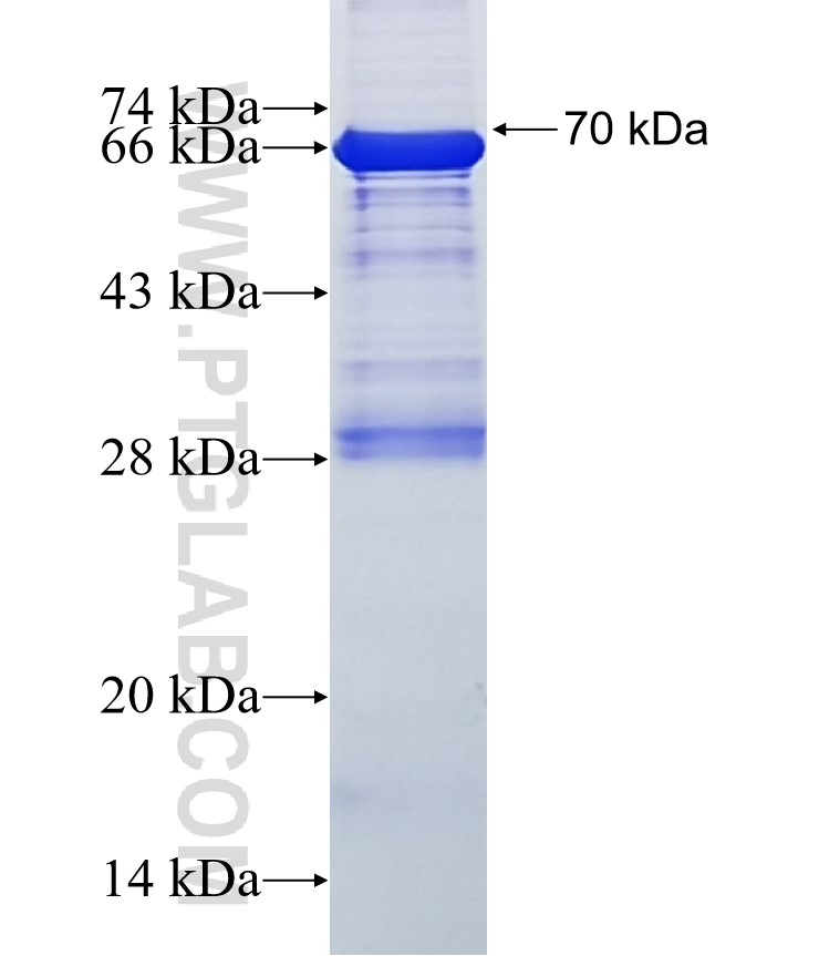 BEST4 fusion protein Ag13022 SDS-PAGE