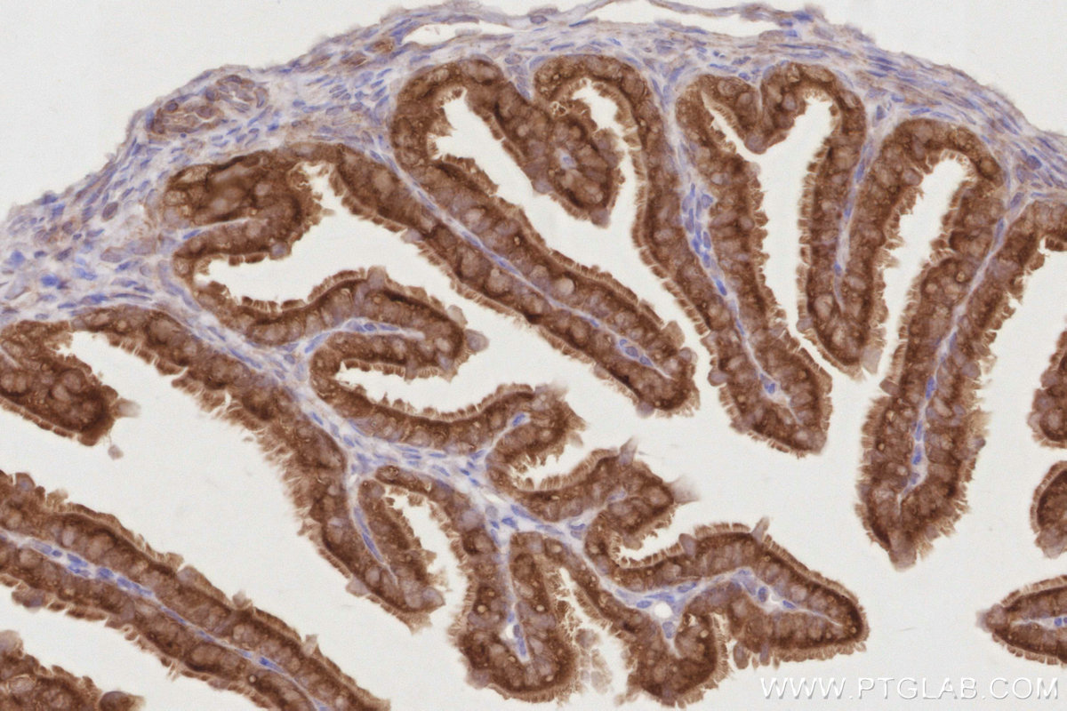 IHC staining of mouse ovary using 12390-1-AP IHC staining of mouse ovary using 12390-1-AP