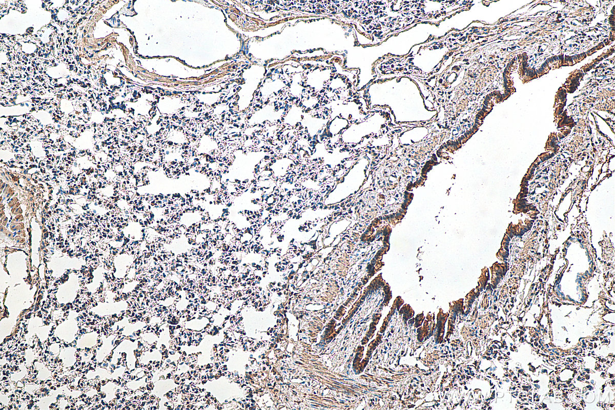 IHC staining of rat lung using 16157-1-AP